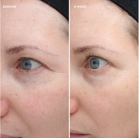 Total Eye Firm & Repair Cream